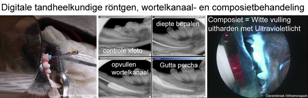 Tandheelkundige digitale rontgen